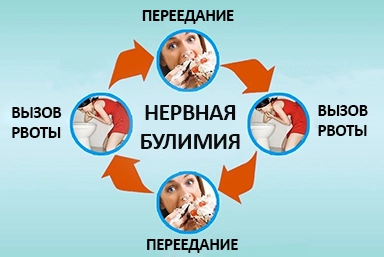 Лечение булимии в Чалтыре